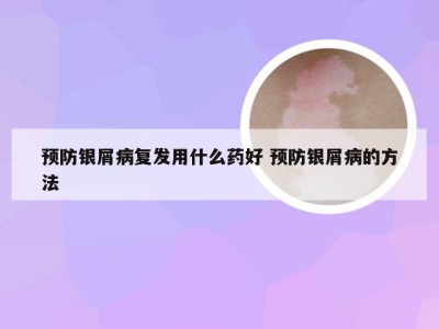 预防银屑病复发用什么药好 预防银屑病的方法