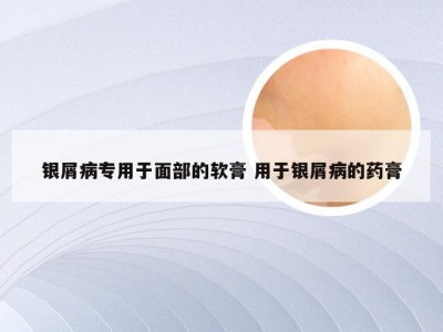 银屑病专用于面部的软膏 用于银屑病的药膏