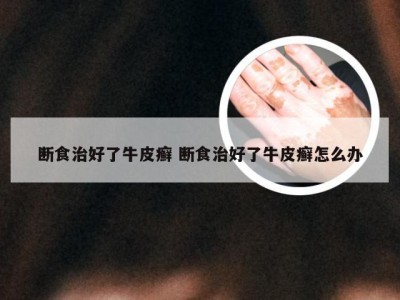 断食治好了牛皮癣 断食治好了牛皮癣怎么办