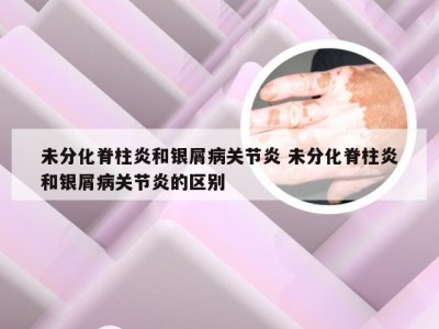 未分化脊柱炎和银屑病关节炎 未分化脊柱炎和银屑病关节炎的区别