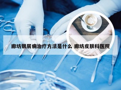 廊坊银屑病治疗方法是什么 廊坊皮肤科医院