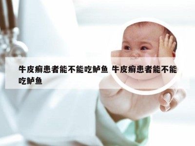 牛皮癣患者能不能吃鲈鱼 牛皮癣患者能不能吃鲈鱼
