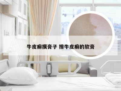 牛皮癣摸膏子 擦牛皮癣的软膏