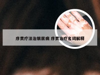 序贯疗法治银屑病 序贯治疗名词解释