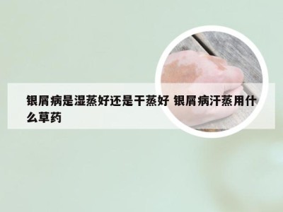 银屑病是湿蒸好还是干蒸好 银屑病汗蒸用什么草药