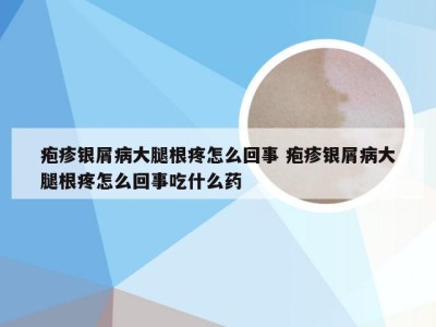 疱疹银屑病大腿根疼怎么回事 疱疹银屑病大腿根疼怎么回事吃什么药