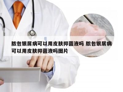 脓包银屑病可以用皮肤抑菌液吗 脓包银屑病可以用皮肤抑菌液吗图片
