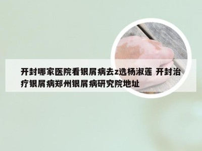 开封哪家医院看银屑病去z选杨淑莲 开封治疗银屑病郑州银屑病研究院地址