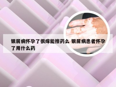 银屑病怀孕了很痒能擦药么 银屑病患者怀孕了用什么药