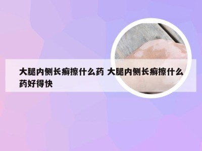 大腿内侧长癣擦什么药 大腿内侧长癣擦什么药好得快