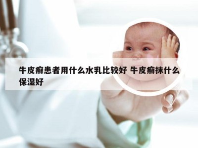 牛皮癣患者用什么水乳比较好 牛皮癣抹什么保湿好