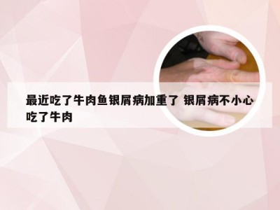 最近吃了牛肉鱼银屑病加重了 银屑病不小心吃了牛肉