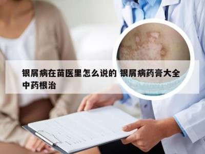银屑病在苗医里怎么说的 银屑病药膏大全 中药根治
