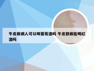 牛皮癣病人可以喝葡萄酒吗 牛皮肤癣能喝红酒吗