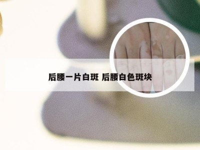 后腰一片白斑 后腰白色斑块