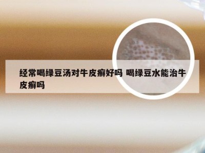 经常喝绿豆汤对牛皮癣好吗 喝绿豆水能治牛皮癣吗