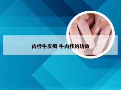 肉桂牛皮癣 牛肉桂的功效