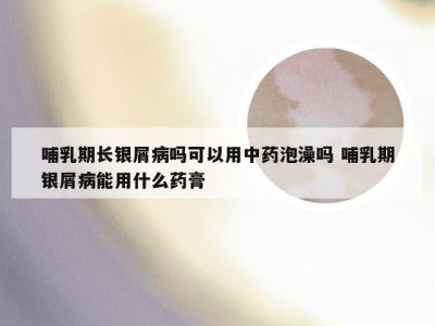 哺乳期长银屑病吗可以用中药泡澡吗 哺乳期银屑病能用什么药膏