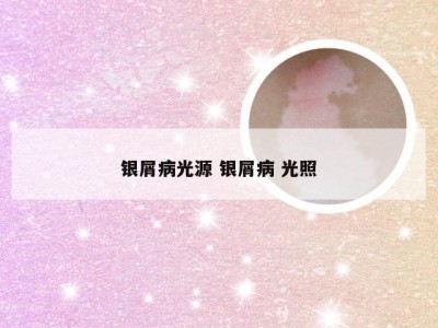 银屑病光源 银屑病 光照