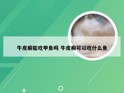 牛皮癣能吃甲鱼吗 牛皮癣可以吃什么鱼