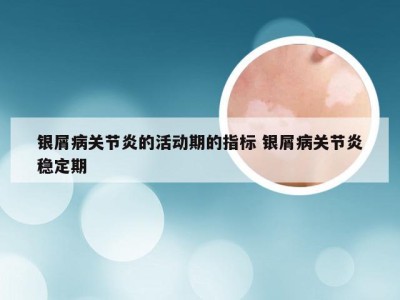 银屑病关节炎的活动期的指标 银屑病关节炎稳定期