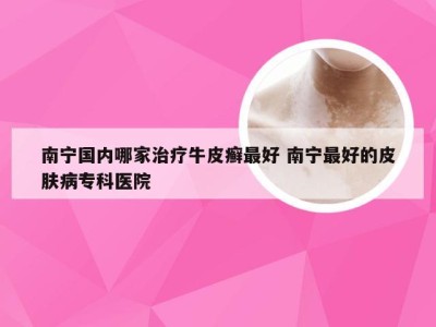 南宁国内哪家治疗牛皮癣最好 南宁最好的皮肤病专科医院