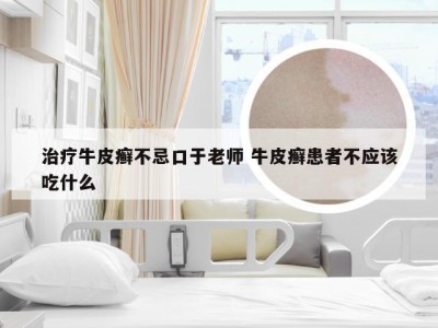 治疗牛皮癣不忌口于老师 牛皮癣患者不应该吃什么
