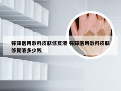 弥藓医用敷料皮肤修复液 弥藓医用敷料皮肤修复液多少钱