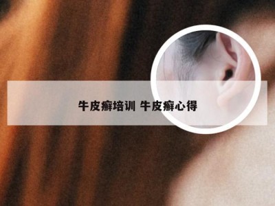牛皮癣培训 牛皮癣心得