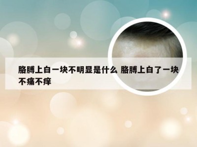 胳膊上白一块不明显是什么 胳膊上白了一块不痛不痒