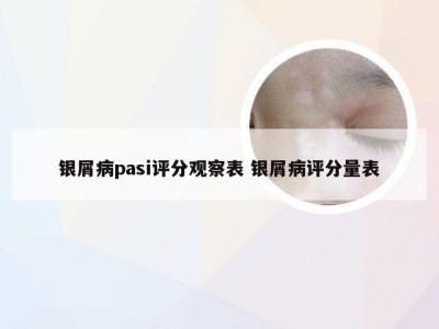 银屑病pasi评分观察表 银屑病评分量表