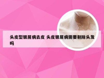 头皮型银屑病去皮 头皮银屑病需要剔除头发吗