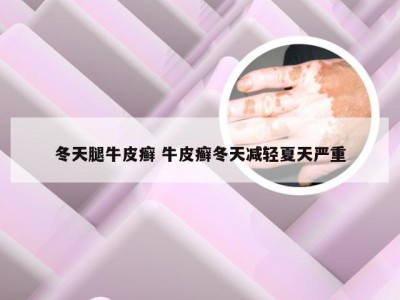 冬天腿牛皮癣 牛皮癣冬天减轻夏天严重
