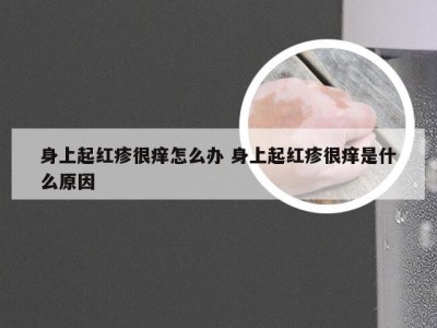 身上起红疹很痒怎么办 身上起红疹很痒是什么原因