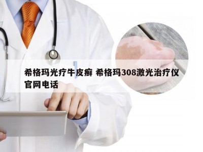 希格玛光疗牛皮癣 希格玛308激光治疗仪官网电话
