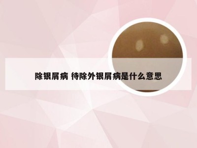 除银屑病 待除外银屑病是什么意思