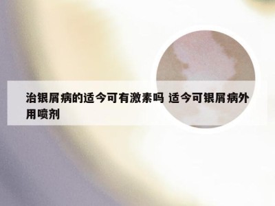 治银屑病的适今可有激素吗 适今可银屑病外用喷剂