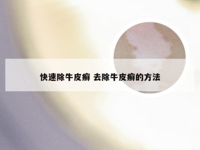 快速除牛皮癣 去除牛皮癣的方法