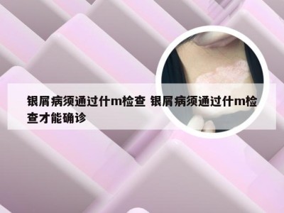 银屑病须通过什m检查 银屑病须通过什m检查才能确诊