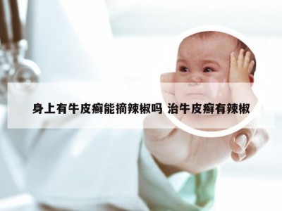 身上有牛皮癣能摘辣椒吗 治牛皮癣有辣椒