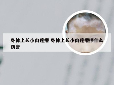 身体上长小肉疙瘩 身体上长小肉疙瘩擦什么药膏