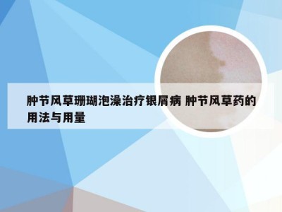 肿节风草珊瑚泡澡治疗银屑病 肿节风草药的用法与用量