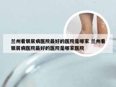 兰州看银屑病医院最好的医院是哪家 兰州看银屑病医院最好的医院是哪家医院