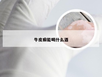 牛皮癣能喝什么酒