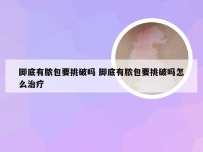 脚底有脓包要挑破吗 脚底有脓包要挑破吗怎么治疗