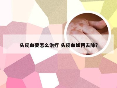 头皮血要怎么治疗 头皮血如何去除?