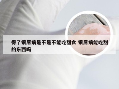 得了银屑病是不是不能吃甜食 银屑病能吃甜的东西吗