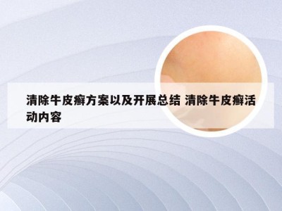清除牛皮癣方案以及开展总结 清除牛皮癣活动内容