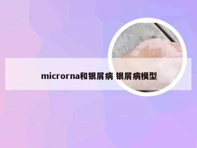 microrna和银屑病 银屑病模型