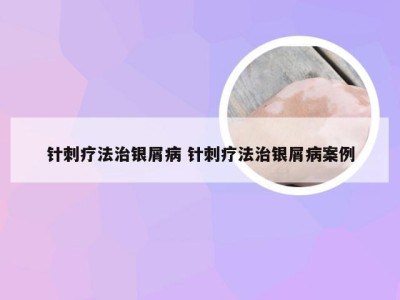 针刺疗法治银屑病 针刺疗法治银屑病案例